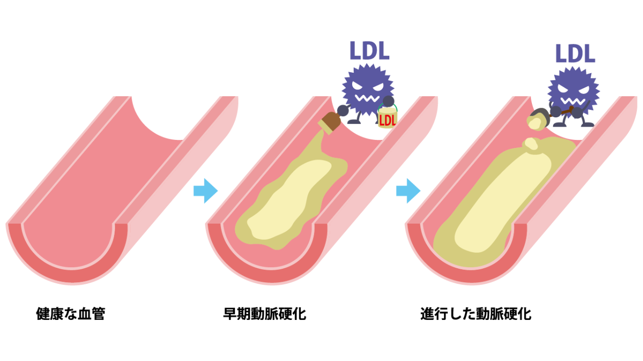 コレステロール値を下げる飲み物